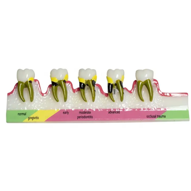 Dental Periodontal Disease Assort Model